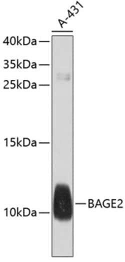 Invitrogen BAGE2 Polyclonal Antibody 100 &mu;L; Unconjugated:Antibodies,