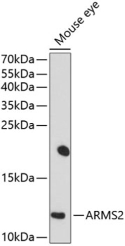 Invitrogen ARMS2 Polyclonal Antibody 100 &mu;L; Unconjugated:Antibodies,