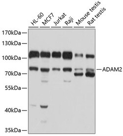 Invitrogen ADAM2 Polyclonal Antibody 100 &mu;L; Unconjugated:Antibodies,