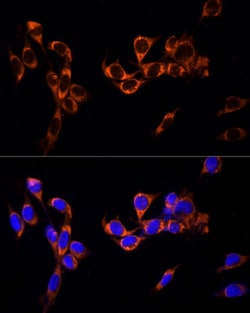 Invitrogen GPR30 Polyclonal Antibody 100 &mu;L | Buy Online | Invitrogen&trade; | Fisher Scientific