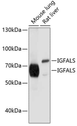 Invitrogen ALS Polyclonal Antibody 100 &mu;L; Unconjugated:Antibodies,