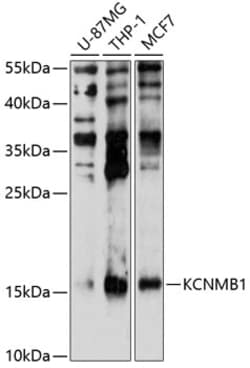 Invitrogen KCNMB1 Polyclonal Antibody 100 &mu;L; Unconjugated:Antibodies,