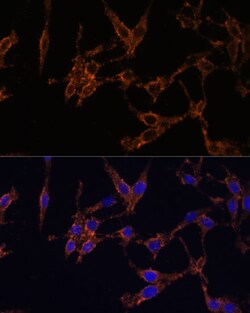 Invitrogen 14-3-3 beta Polyclonal Antibody 100 &mu;L; Unconjugated:Antibodies,