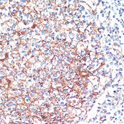Invitrogen 14-3-3 beta Polyclonal Antibody 100 &mu;L; Unconjugated:Antibodies,