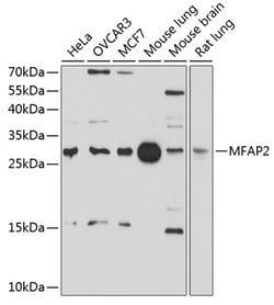 Invitrogen MFAP2 Polyclonal Antibody 100 &mu;L | Buy Online | Invitrogen&trade; | Fisher Scientific