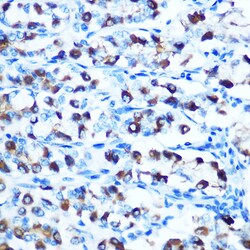 Invitrogen SLC11A2 Polyclonal Antibody 100 &mu;L; Unconjugated:Antibodies,