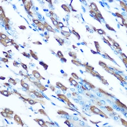 Invitrogen SLC11A2 Polyclonal Antibody 100 &mu;L; Unconjugated:Antibodies,