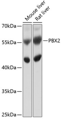 Invitrogen PBX2 Polyclonal Antibody 100 &mu;L; Unconjugated:Antibodies,