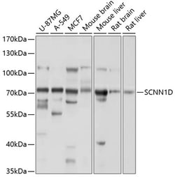 Invitrogen SCNN1D Polyclonal Antibody 100 &mu;L; Unconjugated:Antibodies,