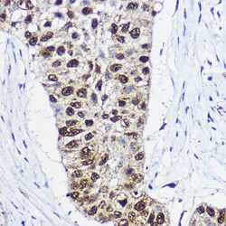 Invitrogen SMARCA1 Polyclonal Antibody 100 &mu;L; Unconjugated:Antibodies,