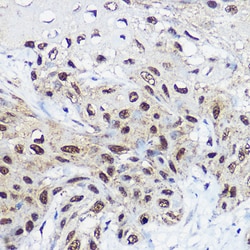 Invitrogen SMARCA1 Polyclonal Antibody 100 &mu;L; Unconjugated:Antibodies,