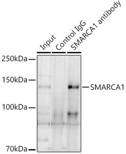 Invitrogen SMARCA1 Polyclonal Antibody 100 &mu;L; Unconjugated:Antibodies,