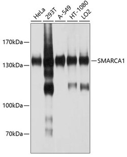 Invitrogen SMARCA1 Polyclonal Antibody 100 &mu;L; Unconjugated:Antibodies,