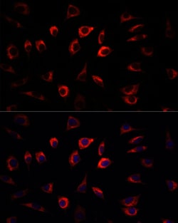 Invitrogen SGK1 Polyclonal Antibody 100 &mu;L; Unconjugated:Antibodies,