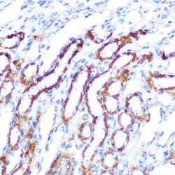 Invitrogen SGK1 Polyclonal Antibody 100 &mu;L; Unconjugated:Antibodies,