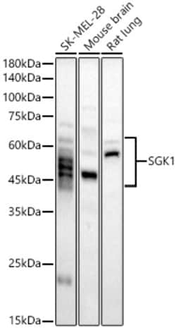 Invitrogen SGK1 Polyclonal Antibody 100 &mu;L; Unconjugated:Antibodies,