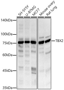 Invitrogen TBX2 Polyclonal Antibody 100 &mu;L; Unconjugated:Antibodies,