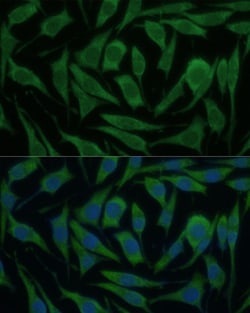 Invitrogen KIF14 Polyclonal Antibody 100 &mu;L; Unconjugated:Antibodies,