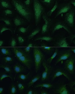 Invitrogen KIF14 Polyclonal Antibody 100 &mu;L; Unconjugated:Antibodies,