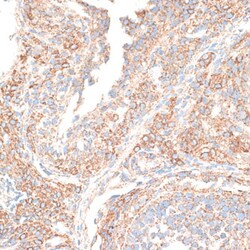 Invitrogen KIF14 Polyclonal Antibody 100 &mu;L; Unconjugated:Antibodies,