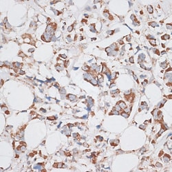 Invitrogen KIF14 Polyclonal Antibody 100 &mu;L; Unconjugated:Antibodies,