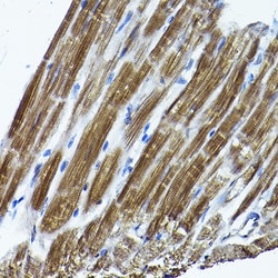 Invitrogen ICMT Polyclonal Antibody 100 &mu;L; Unconjugated:Antibodies,