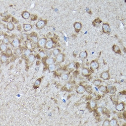 Invitrogen SNAPAP Polyclonal Antibody 100 &mu;L; Unconjugated:Antibodies,