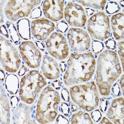 Invitrogen SNAPAP Polyclonal Antibody 100 &mu;L; Unconjugated:Antibodies,