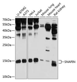 Invitrogen SNAPAP Polyclonal Antibody 100 &mu;L; Unconjugated:Antibodies,
