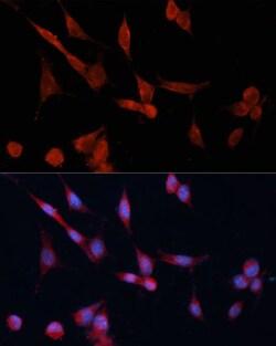 Invitrogen DDAH1 Polyclonal Antibody 100 &mu;L; Unconjugated:Antibodies,