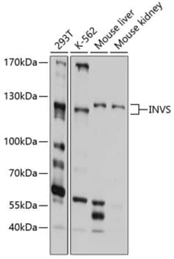 Invitrogen INVS Polyclonal Antibody 100 &mu;L | Buy Online | Invitrogen&trade; | Fisher Scientific