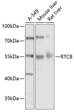 Invitrogen RTCB Polyclonal Antibody 100 &mu;L; Unconjugated:Antibodies,