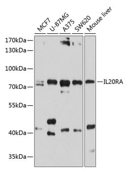 Invitrogen IL20RA Polyclonal Antibody 100 &mu;L; Unconjugated:Antibodies,