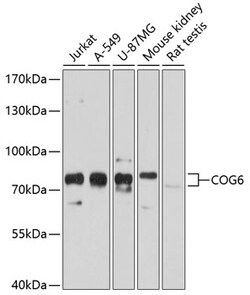 Invitrogen COG6 Polyclonal Antibody 100 &mu;L; Unconjugated:Antibodies,