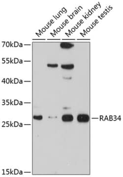 Invitrogen RAB34 Polyclonal Antibody 100 &mu;L; Unconjugated:Antibodies,