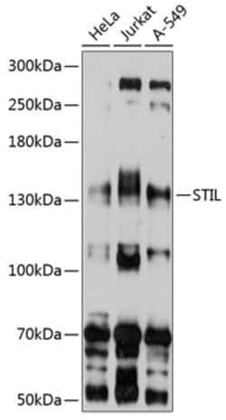 Invitrogen STIL Polyclonal Antibody 100 &mu;L; Unconjugated:Antibodies,