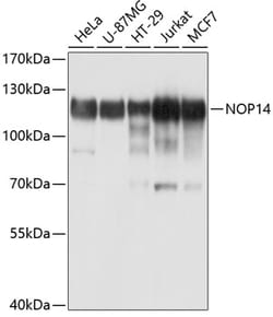 Invitrogen NOP14 Polyclonal Antibody 100 &mu;L; Unconjugated:Antibodies,
