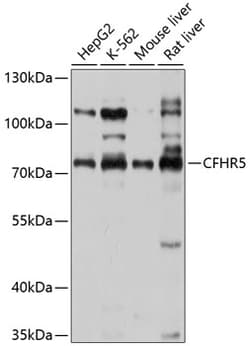 Invitrogen CFHR5 Polyclonal Antibody 100 &mu;L; Unconjugated:Antibodies,