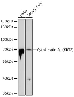 Invitrogen Cytokeratin 2e Polyclonal Antibody 100 &mu;L; Unconjugated:Antibodies,