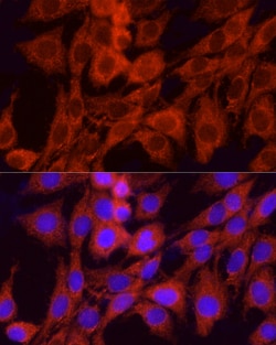 Invitrogen GCLC Polyclonal Antibody 100 &mu;L; Unconjugated:Antibodies,