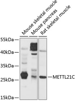 Invitrogen METTL21C Polyclonal Antibody 100 &mu;L; Unconjugated:Antibodies,