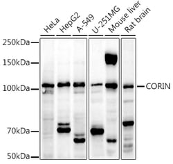 Invitrogen CORIN Polyclonal Antibody 100 &mu;L; Unconjugated:Antibodies,