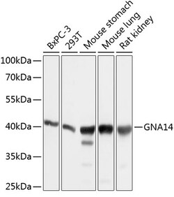 Invitrogen GNA14 Polyclonal Antibody 100 &mu;L | Buy Online | Invitrogen&trade; | Fisher Scientific