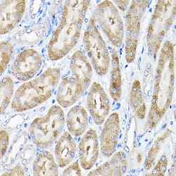Invitrogen THUMPD3 Polyclonal Antibody 100 μL; Unconjugated:Antibodies,