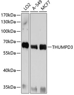 Invitrogen THUMPD3 Polyclonal Antibody 100 μL; Unconjugated:Antibodies,