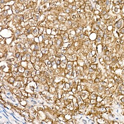 Invitrogen ZIP14 Polyclonal Antibody 100 &mu;L; Unconjugated:Antibodies,