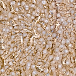 Invitrogen ZIP14 Polyclonal Antibody 100 &mu;L; Unconjugated:Antibodies,