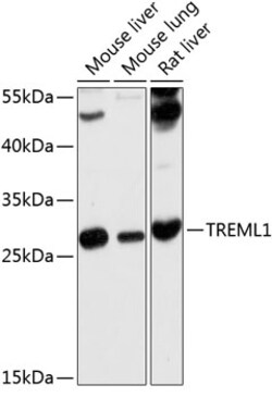 Invitrogen TREML1 Polyclonal Antibody 100 &mu;L; Unconjugated:Antibodies,