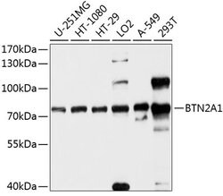 BTN2A1 Polyclonal Antibody, Invitrogen 100 &mu;L; Unconjugated:Antibodies,