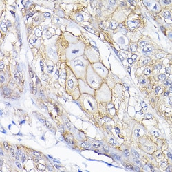 Invitrogen SEMA4F Polyclonal Antibody 100 &mu;L; Unconjugated:Antibodies,
